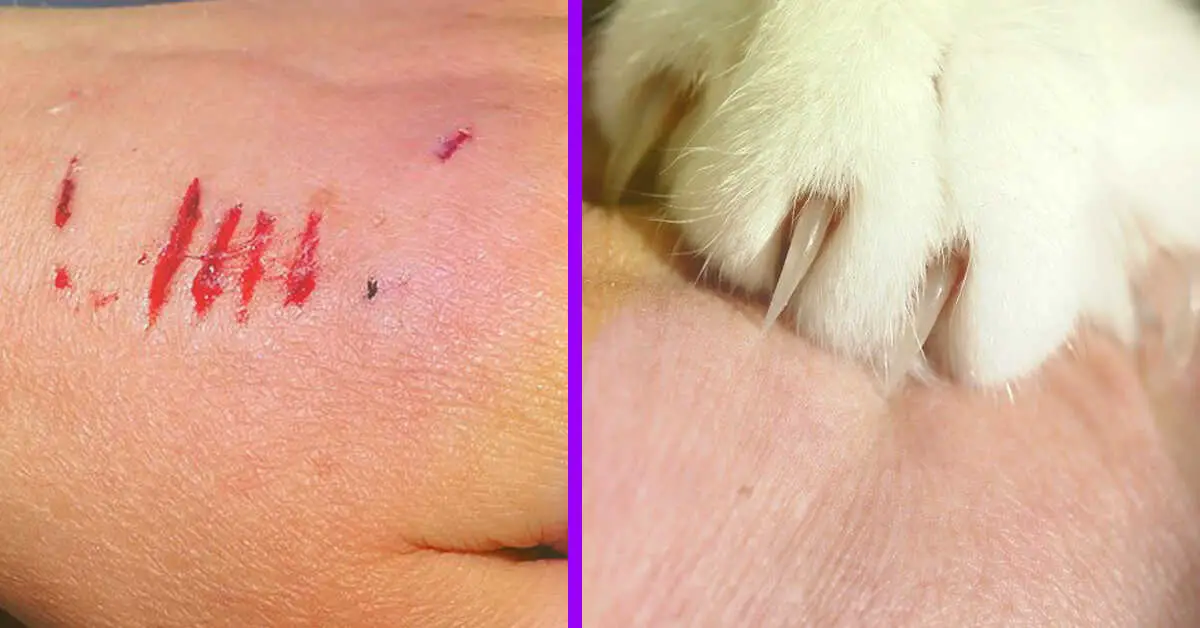 what to do when cat bites and scratches